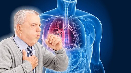 if you or a loved one mesothelioma copy and paste if you or a loved one mesothelioma copy and paste