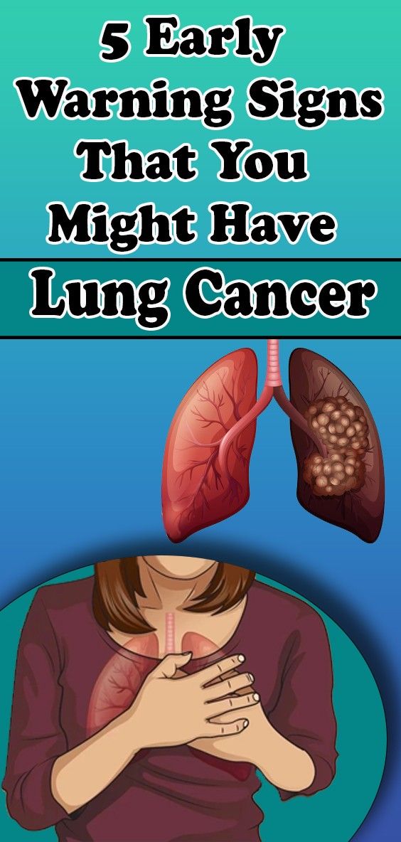 5 Early Warning Signs That You Might Have Lung Cancer Health News