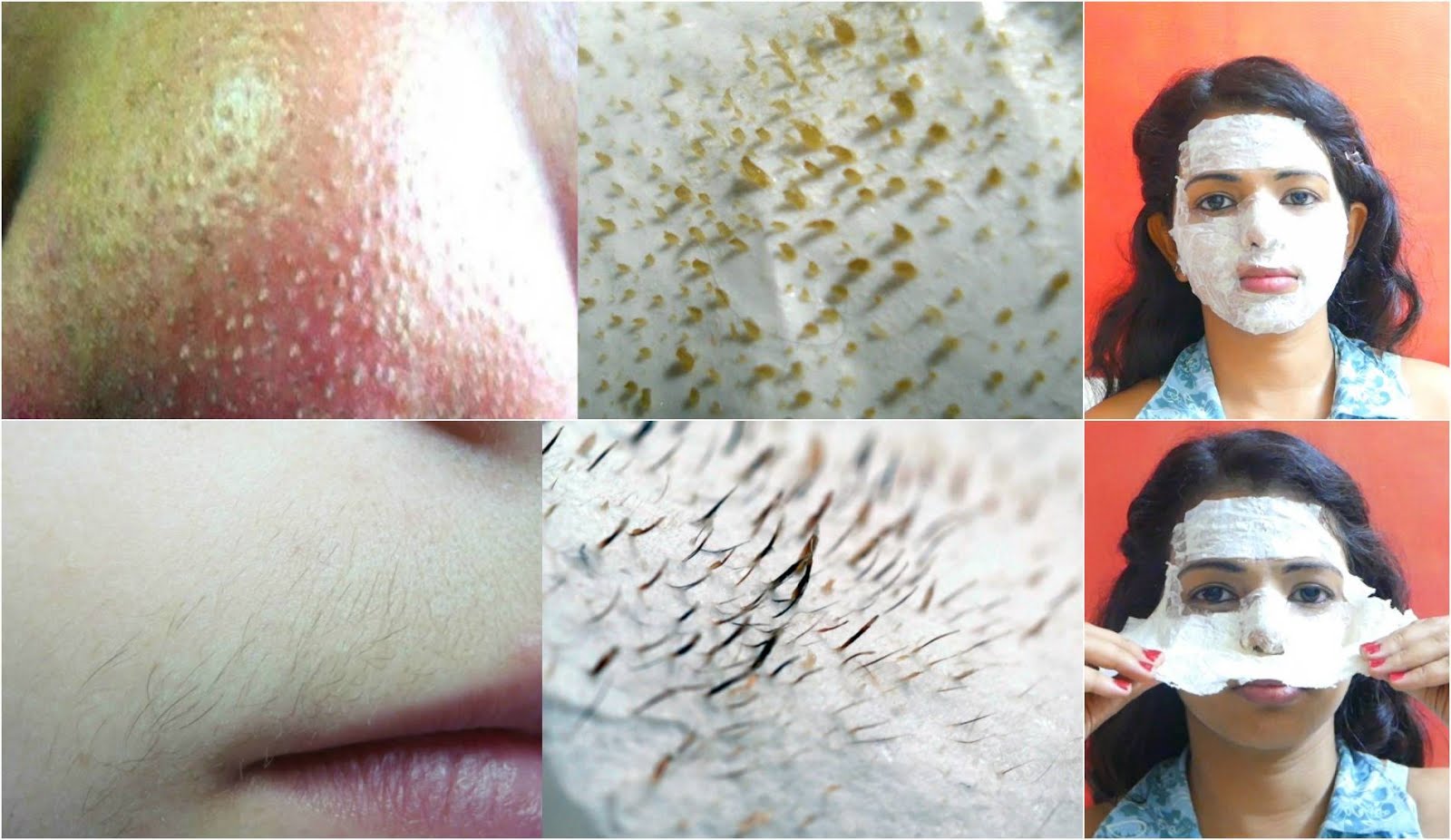 How To Remove Blackheads From Nose Naturally At Home How To Remove Blackheads From Nose Naturally At Home