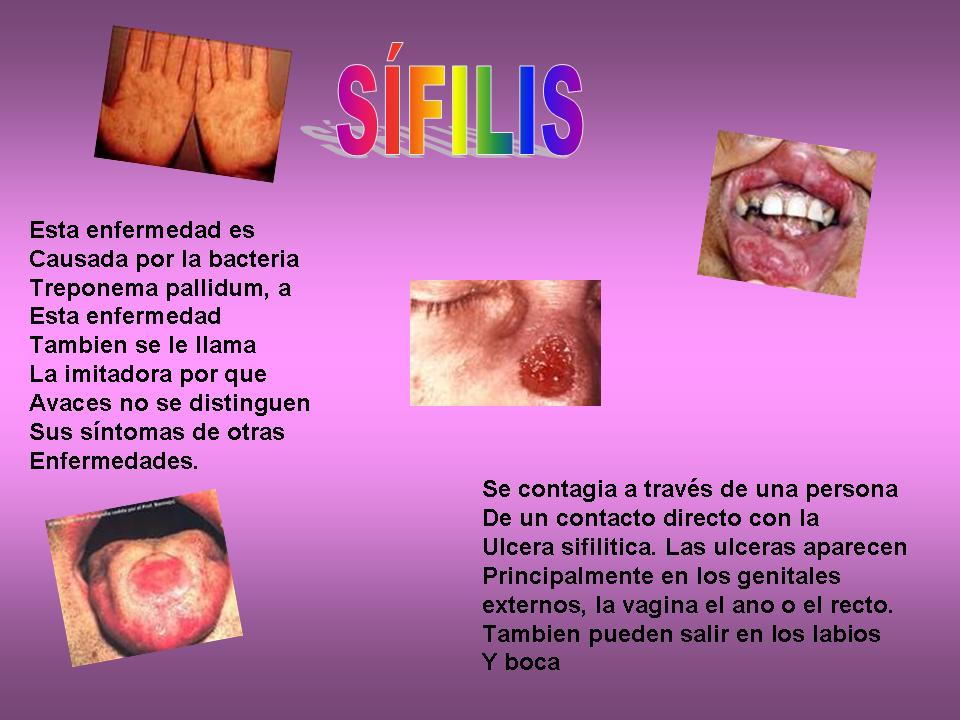 Calentamiento Global ENFERMEDADES DE TRANSMISIÓN SEXUAL