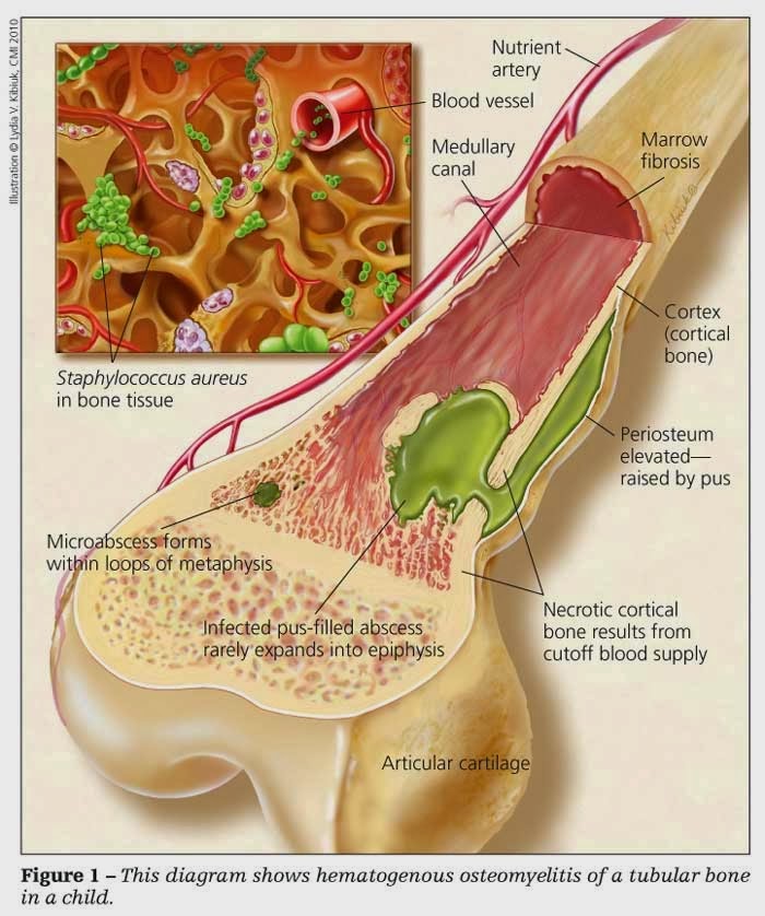 PENYAKIT PADA SISTEM GERAK