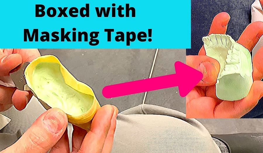 DENTAL IMPRESSION Simplest Impression Boxing Technique Dr. Mishriky