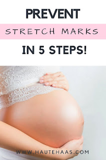 Prevent Stretch Marks During Pregnancy - Easy To Follow Steps How To Prevent Stretch Marks In Five Steps! http://www.hautehaas.com/2018/05/how-to-prevent-stretch-marks-in-5-steps.html