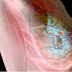Las mamografías sí previenen muertes por cáncer