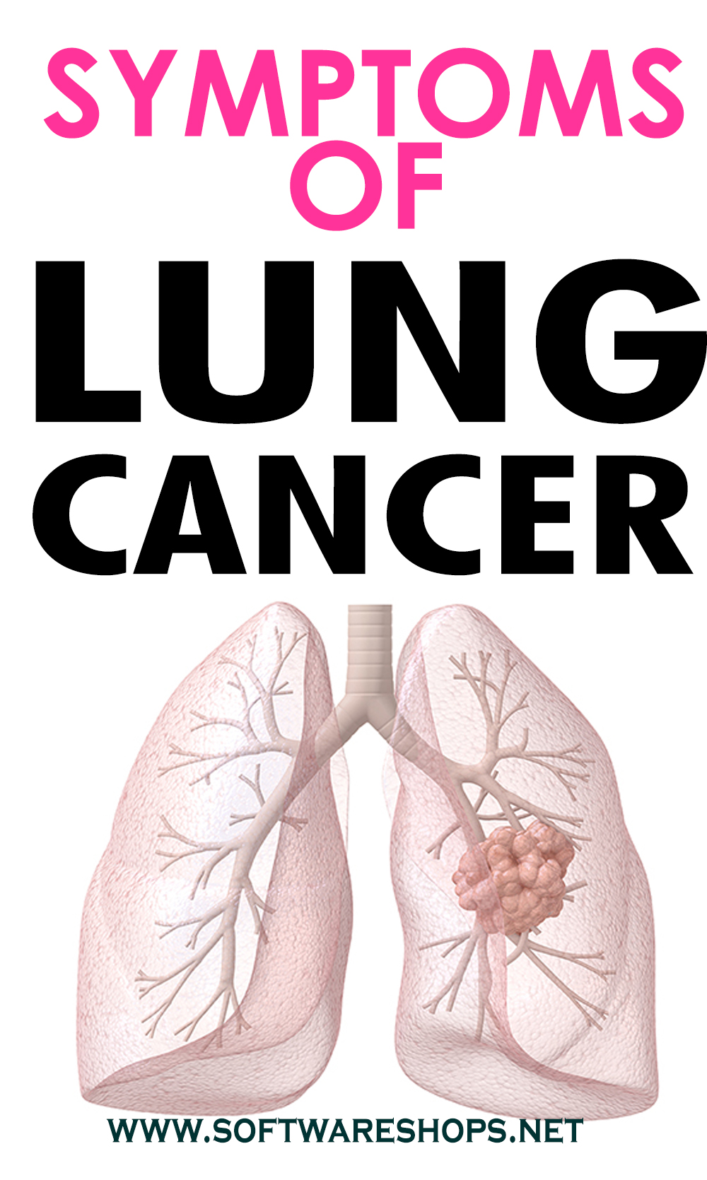 LUNGS CANCER SYMPTOMS IN FEMALE