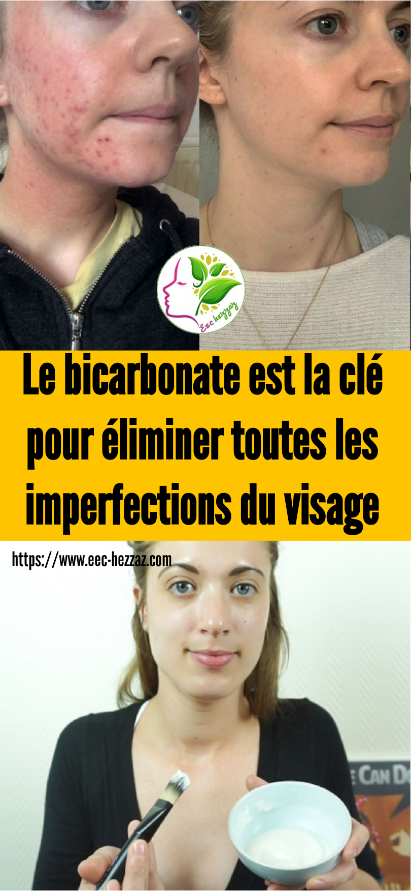 Le bicarbonate est la clé pour éliminer toutes les imperfections du visage