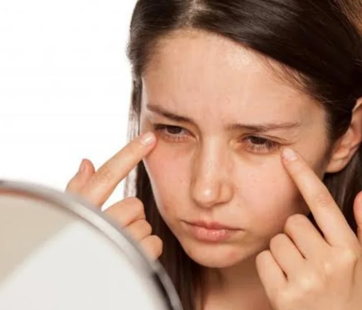 How To Get Rid Of Puffy Eyes?