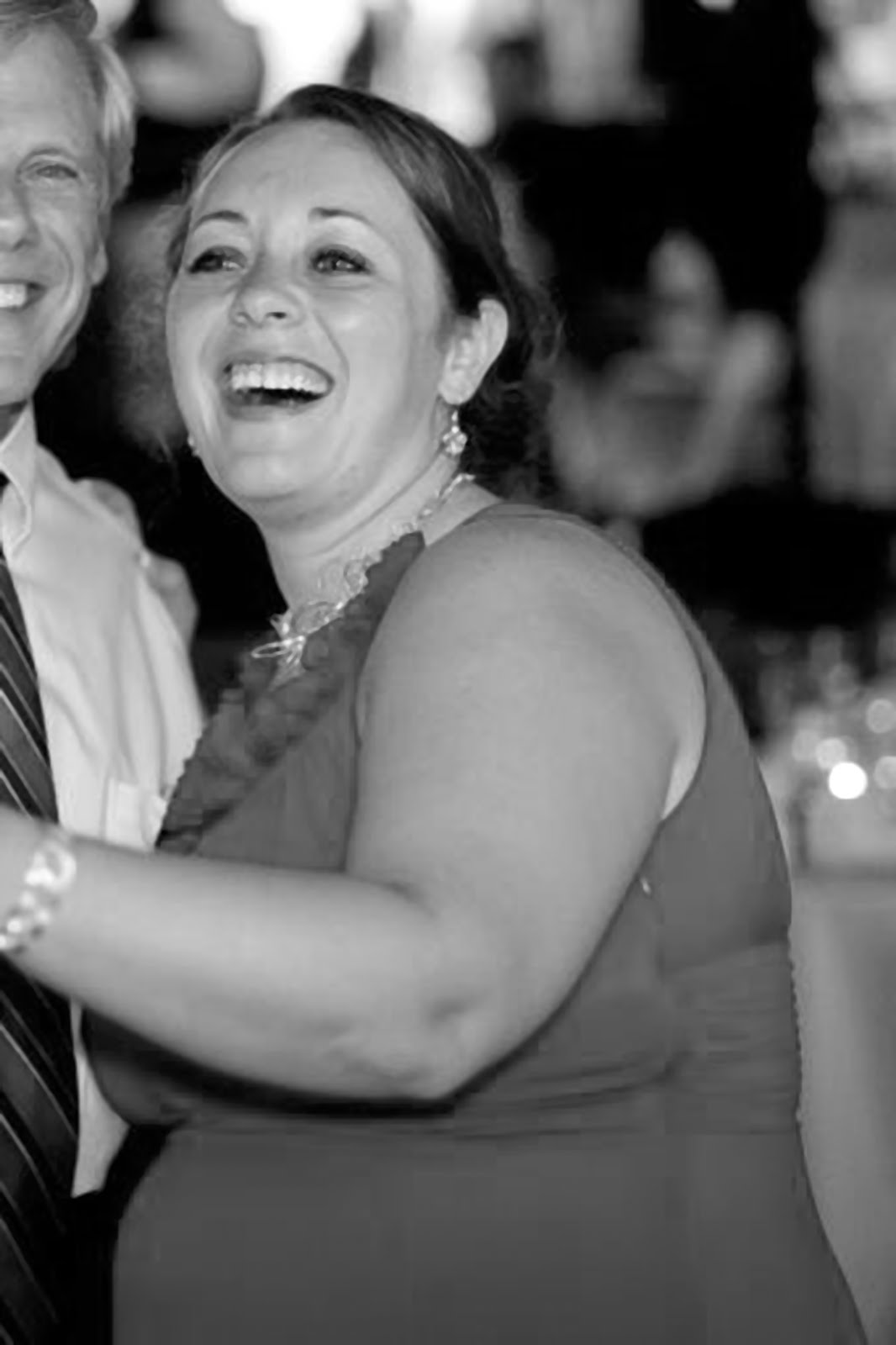 Sudden change in breast size picture