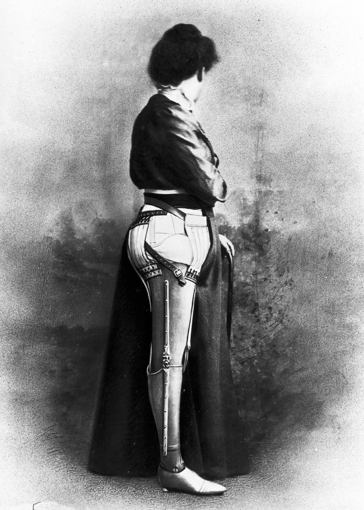The extraordinary early prostheses made by James Gillingham  1900 - 98