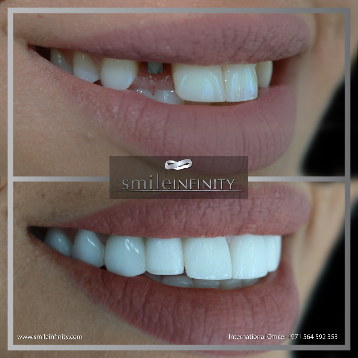 Hollywood Smile Lebanon Elite dentists at CMC Hospital affiliated with