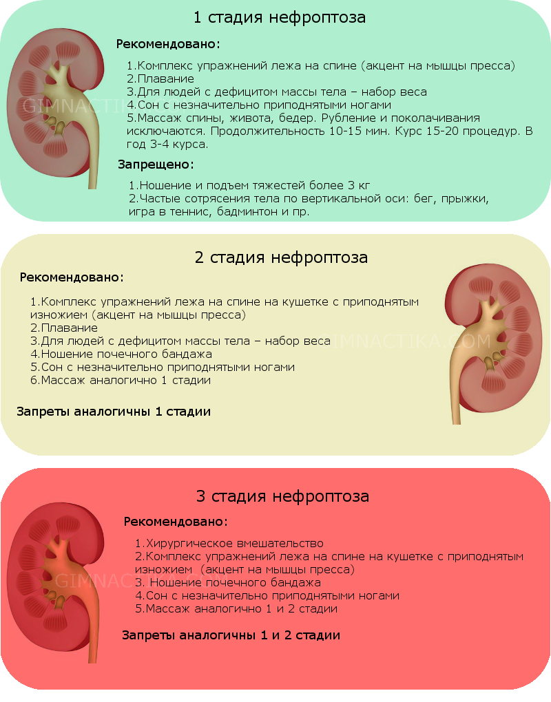 нефроптоз 2 степени правой почки. нефроптоз степени опущения. избыточная подвижность правой почки. что такое избыточность подвижность почки. повышена подвижность правой почки.