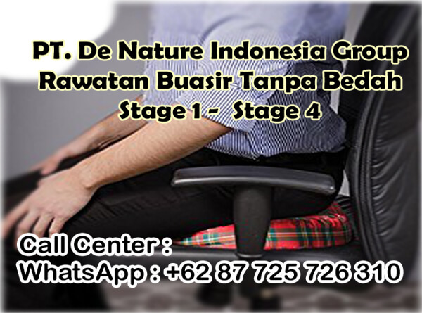 ubat buasir tahap 4 de nature