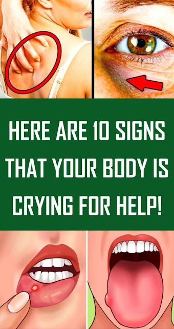 Here Are 10 Signs That Your Body Is Crying For Help!