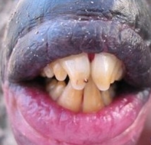 AJORBAHMAN'S COLLECTION: Fish with Real Human Teeth