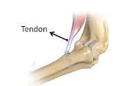 Tendon (urat daging) Tendon (urat daging)