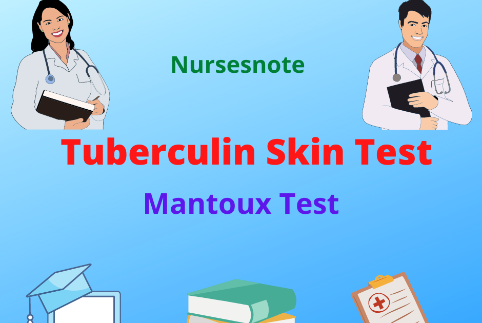 Tuberculin Skin Test Mantoux Test Procedure Nursing Considerations tuberculin-skin-test-mantoux-test-procedure-nursing-considerations