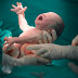 El 90 por ciento de los partos en los centros privados son cesáreas