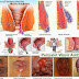 Obat Bebas Wasir Berdarah Tanpa Operasi thumbnail