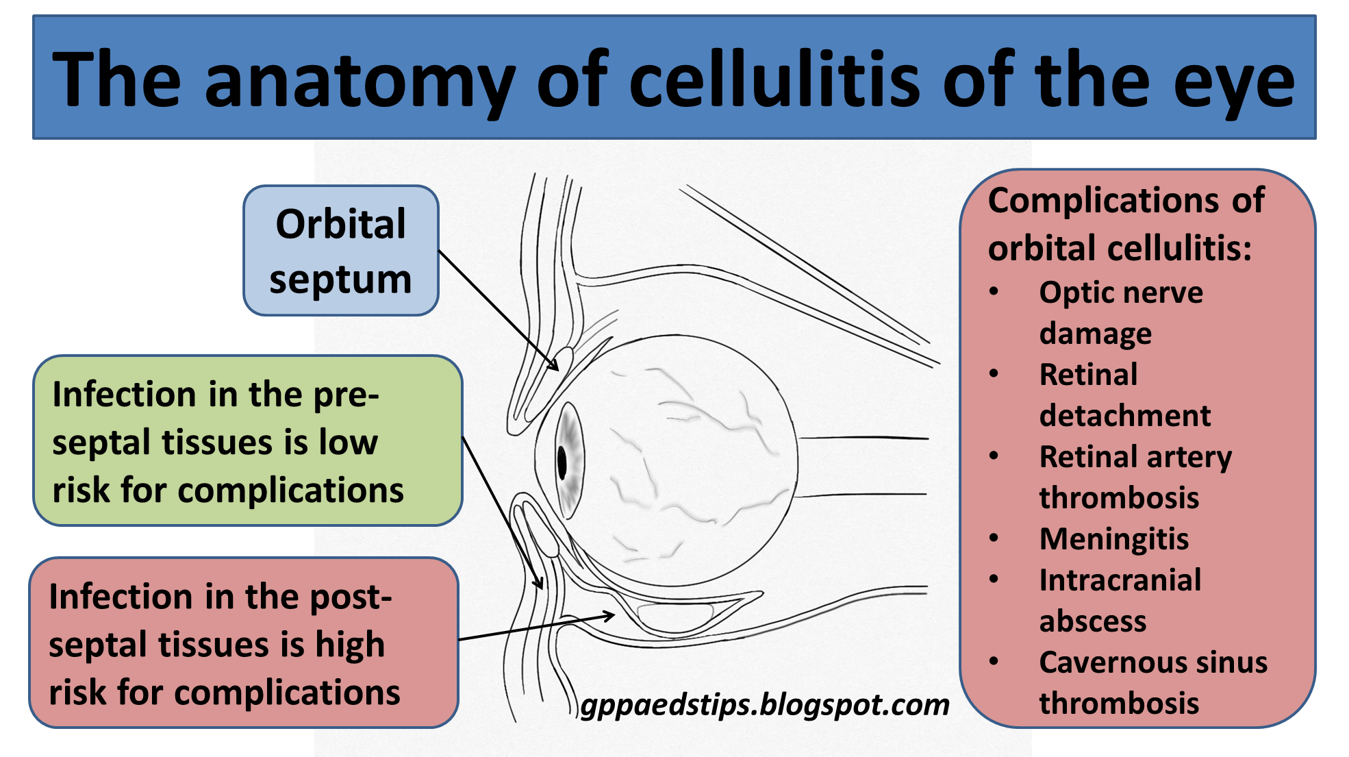 periorbital cellulitis contagious