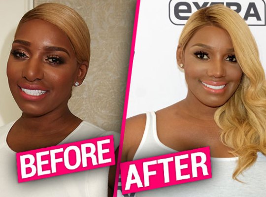 Plastic surgery rumors have been swirling around NeNe Leakes recently