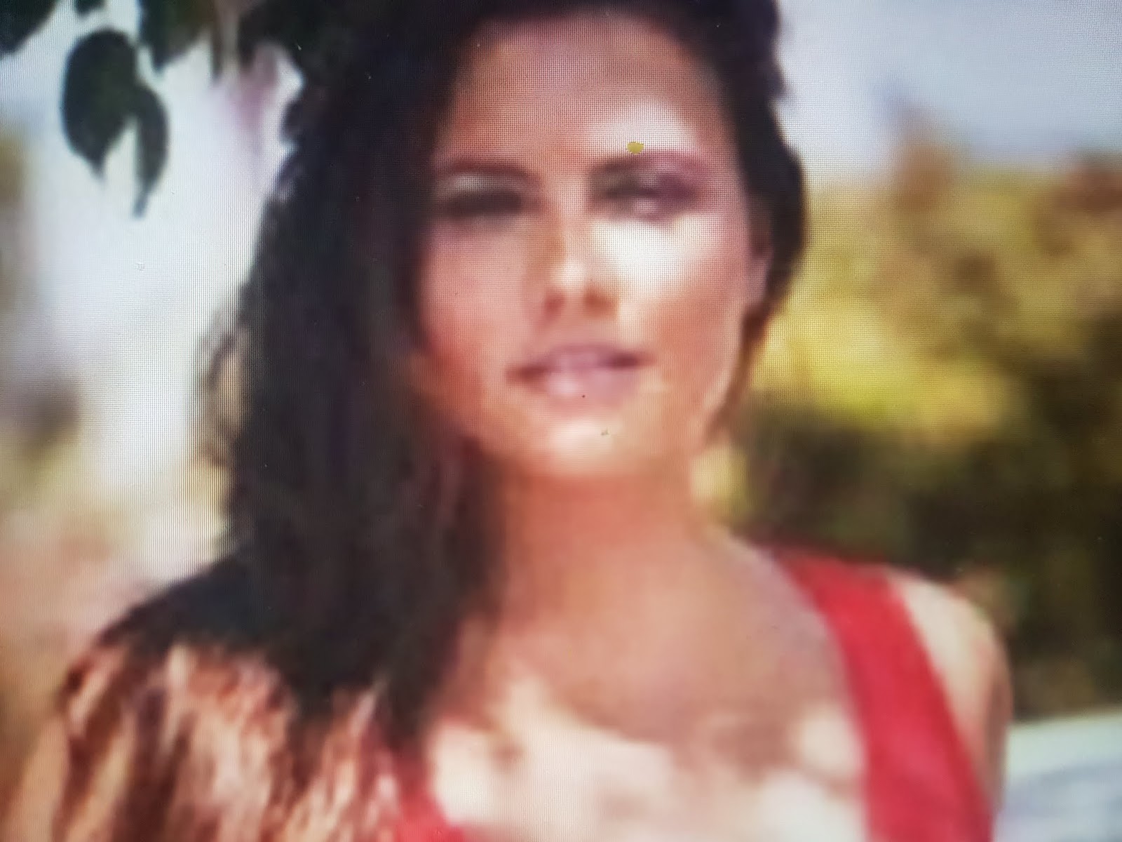 cift kat flep yontemi ile tek kat flep