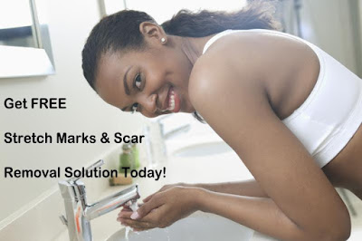 o 2 simple secrets any woman can use to remove stubborn stretch marks & scar in 2weeks (without surgery), get free treatment today!