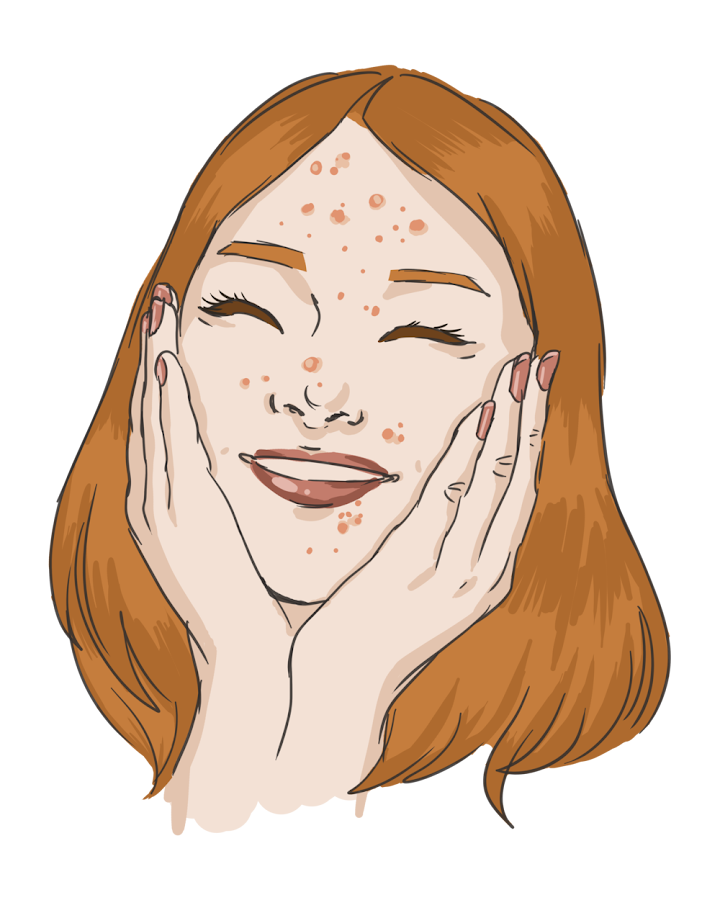 8 mitos y verdades sobre le acné | Belleza