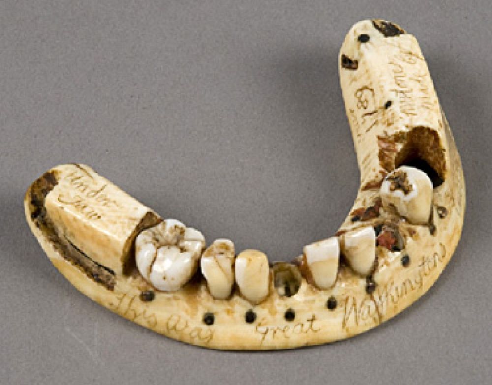 Many of the Dentures in the 18th and 19th Centuries Were Made From the