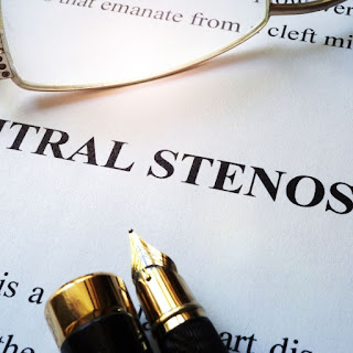 Stenosis mitral terjadi ketika katup mitral tidak cukup terbuka. Ini sangat spesifik dan paling sering disebabkan oleh demam rematik.