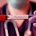 Informe de situación sobre coronavirus COVID-19 en Uruguay