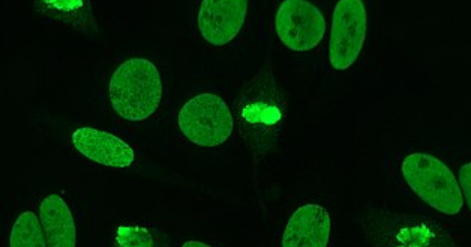 آنا الأجسام المضادة النووية