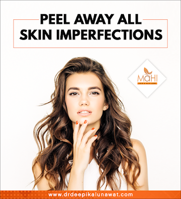 https://www.drdeepikalunawat.com/clinical-services/chemical-peels