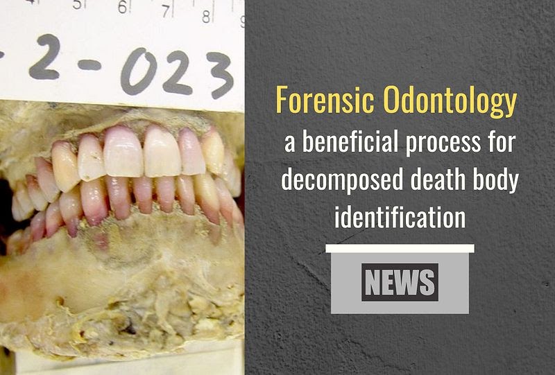 FORENSIC ODONTOLOGY a beneficial process for death body