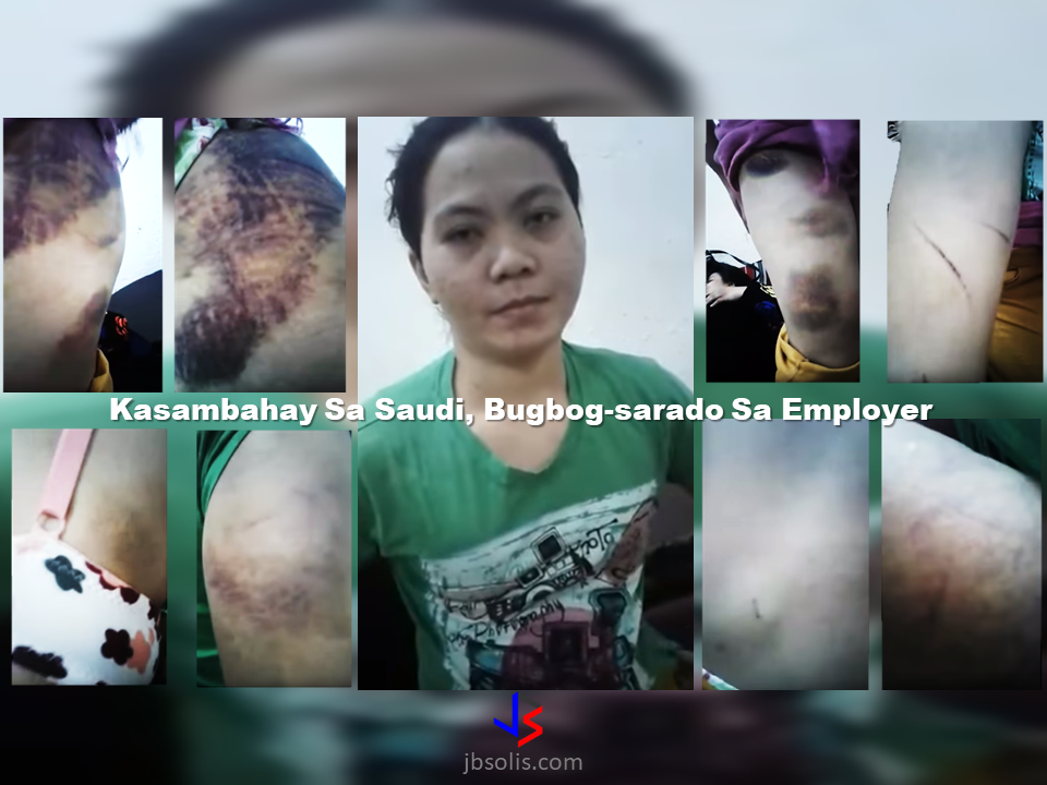 A facebook user uploaded a video of an allegedly maltreated OFW in Saudi Arabia. Marilou Contreras, hailed from Davao, showed her huge black bruises all over her body  which according to her was from severe beating of her employer that she was suffering for about a year now aside from not giving her salary for the period of nine(9) months.           These horrific photos screen-grabbed from the video uploaded by a concerned citizen can speak for themselves how ruthless her employer treated her.     The victim who is working as a household service worker in a Saudi family showed her blackened skin due to bruises and cuts, some of which are already healing. The victim, as well as the video uploader appeal for help especially to the concerned authorities. They are urging the netizens to share the video until it catches the attention of the government agencies. According to the uploader, they are presently in a police station in Al Khobar, Saudi Arabia.  The facebook post of Jinkikay Marquizo Cabca has now 176,000 views, 1,600 reactions and almost 7,000 shares as of this writing.  Read More:       ©2017 THOUGHTSKOTO