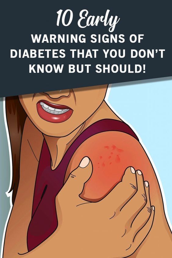 10 Early Warning Signs Of Diabetes Everyone Should Know! - Health Autos