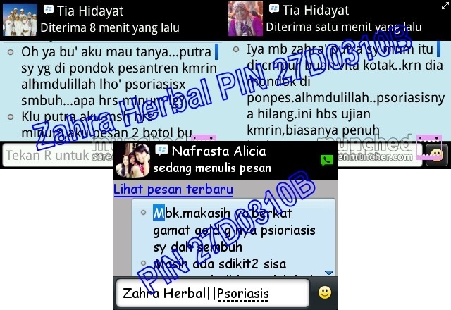 Obat Psoriasis Yang Bagus Obat Psoriasis Yang Bagus
