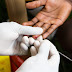 3,891 Test Positive For HIV In IMO State In Just 6 Months