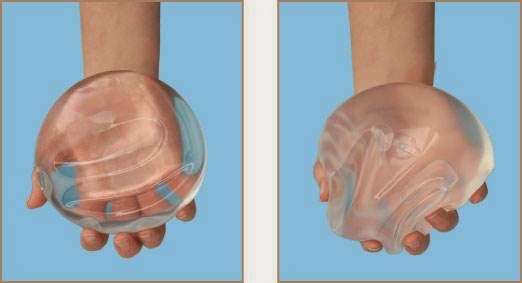 Los tipos de implantes de senos de gel como escoger