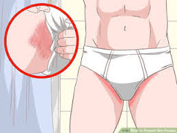 obat jamur gatal pada selangkangan dan bokong