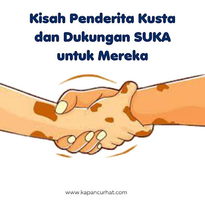 kisah penderita kusta