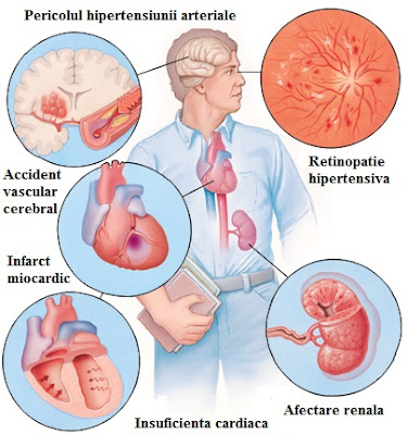 hipertensiune arteriala leziuni de organ