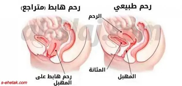 وصفات لتنظيف الرحم وصفات لتنظيف الرحم