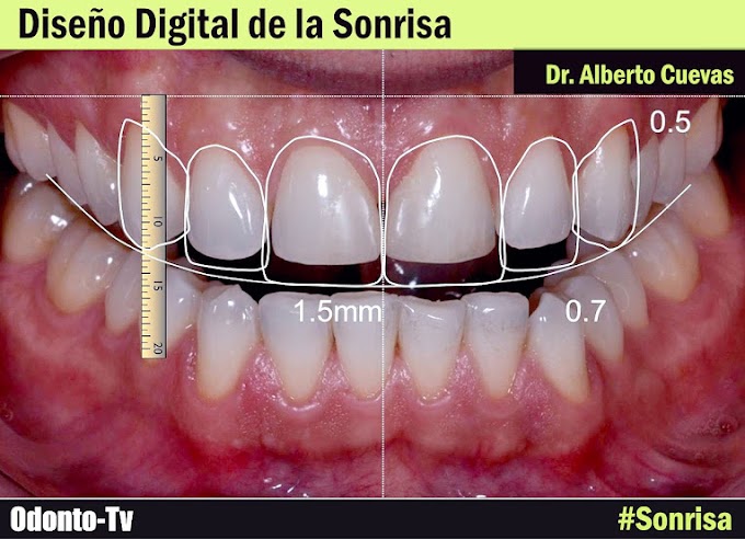ENTREVISTA: Diseño Digital de la Sonrisa - Dr. Alberto Cuevas