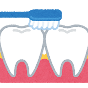  歯間部の歯垢のイラスト