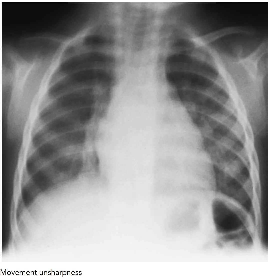 Clark's Radiography Image Sharpness