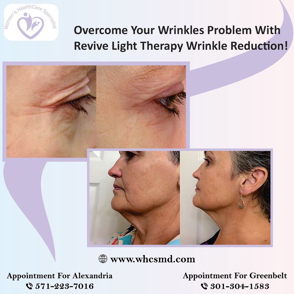 Make Your Skin Appealing With The Revive Light Therapy Wrinkle