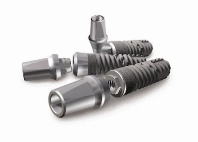 Lịch sử cấy ghép Implant trong nha khoa