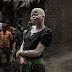 Albino candidates to run for office in Malawi
