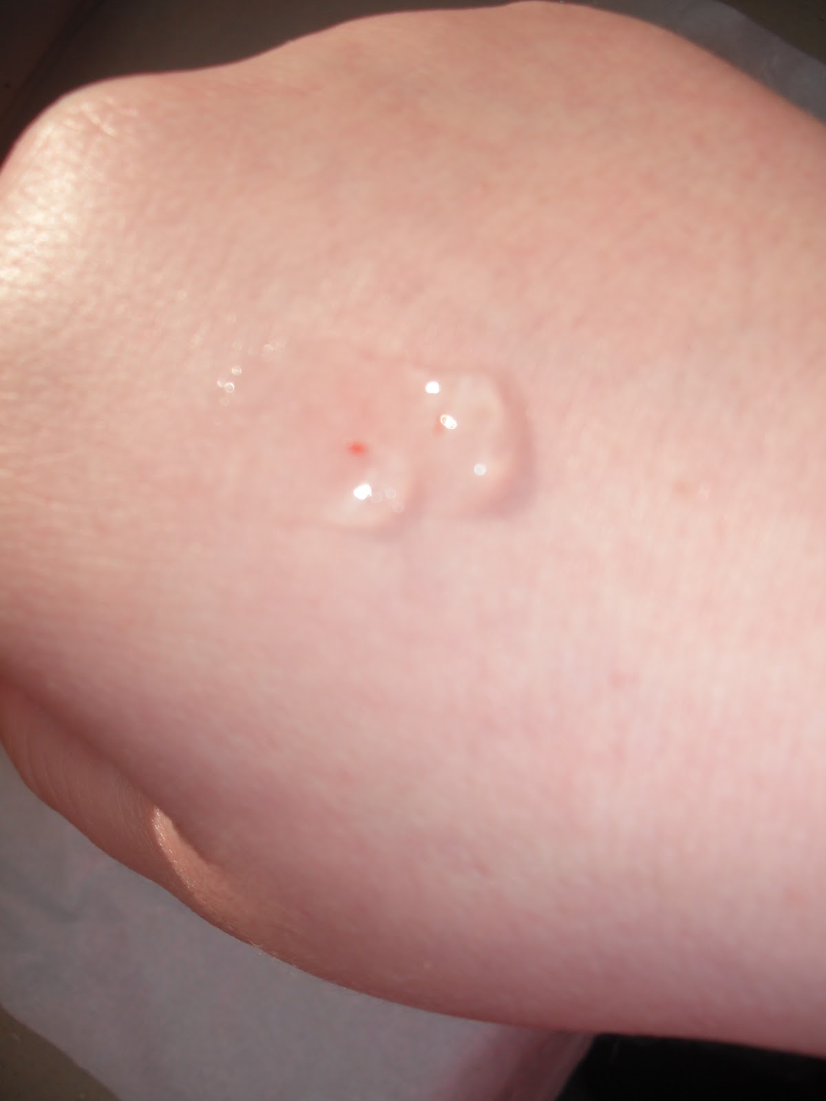 Hautnah Beauty: Rival de Loop Pure Skin - Fruchtsäure Peeling