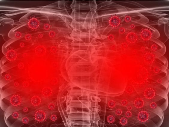 corona in lungs corona in lungs